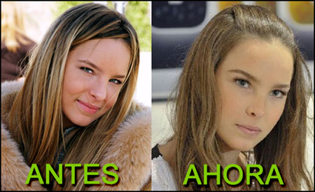Nueva nariz de Belinda align=