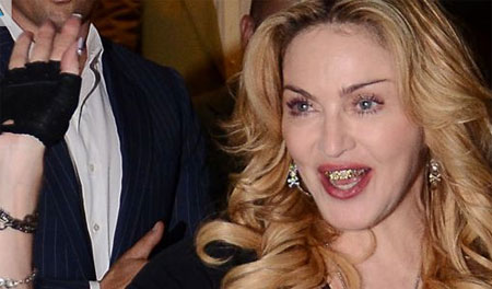 Madonna con dientes de oro y brillantes Madonna con dientes de oro y brillantes align=
