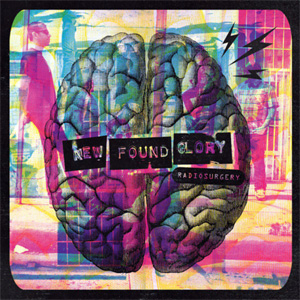 Álbum Radiosurgery de New Found Glory