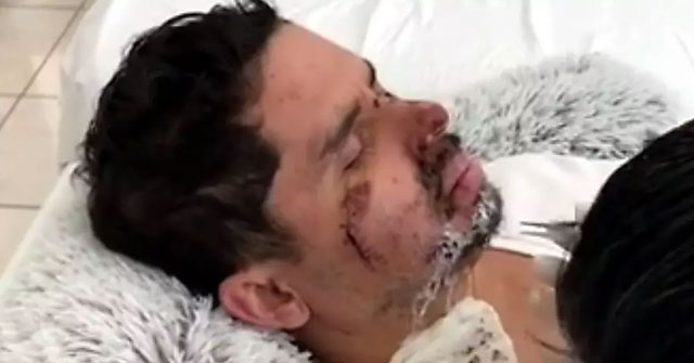 Larry Hernández tomará una pausa de 5 a 7 meses tras accidente (+VÍDEO)