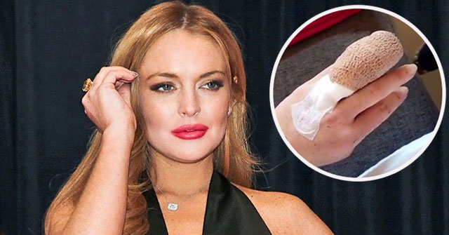 Lindsay Lohan pierde una parte de su dedo anular en un accidente 