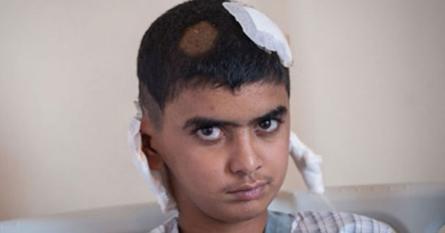 Niño iraquí de 13 años recibe esquirla en el cráneo y vive
