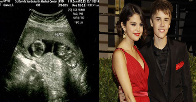 Rumor sobre el embarazo de Selena Gómez ¡ES FALSO!